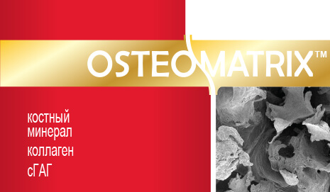 OSTEOMATRIX/ОСТЕОМАТРИКС-ИНСТРУКЦИЯ К ПРИМЕНЕНИЮ